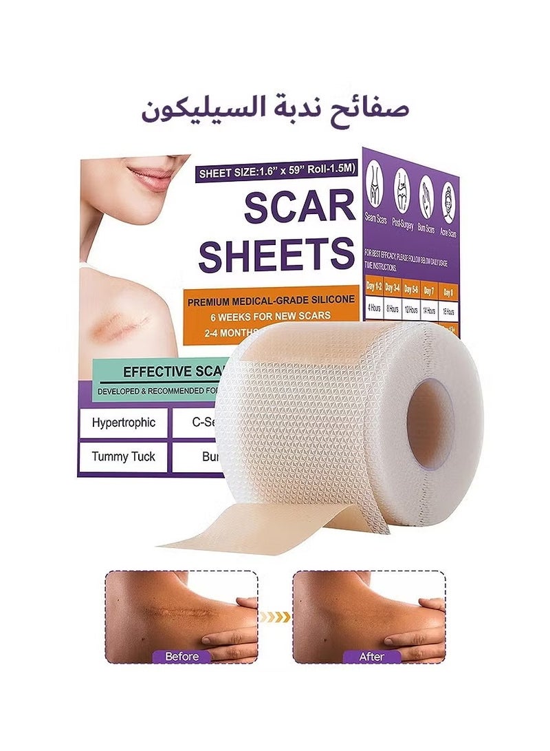 CARVENCHY Silicone Scar Tape, Silicone Scar Removal Sheets For Surgical, Reduces Keloid Visibility For Surgical C-Section Tummy Tuck Keloid Scars - Image 1